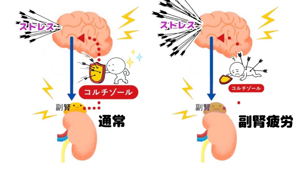 副腎疲労とは